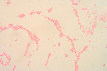 gram negative bacilli.