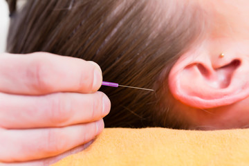 Heilpraktiker sticht Akupunktur Nadel in Ohr