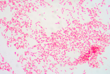 Gram staining ,gram negative bacilli.