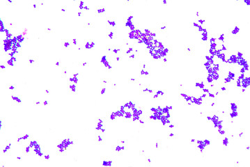 Gram staining,gram positive cocci.