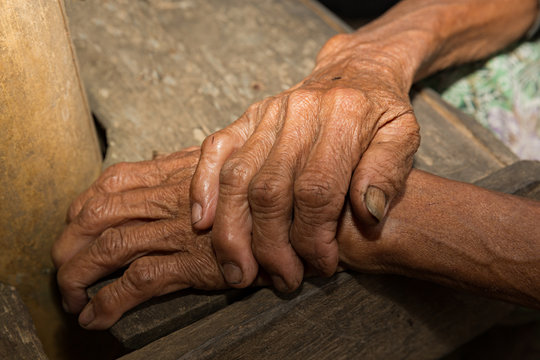 Manos de mujer anciana.