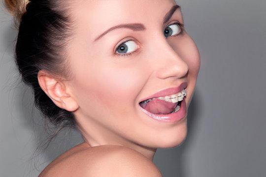 Fuuny Smiling Girl with Ceramic Dental Braces Teeth