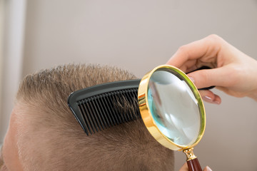 Dermatologist Looking Hair Through Magnifying Glass