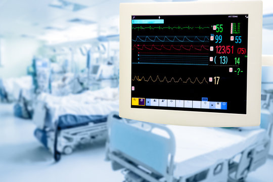 Electrocardiogram monitor in ICU