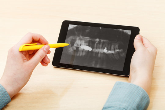 student analyzes human jaws on tablet pc