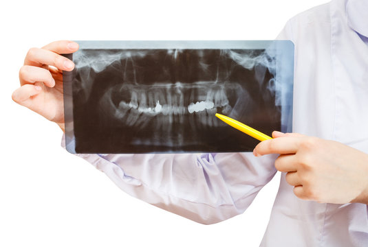 nurse holds X-ray picture with human jaw