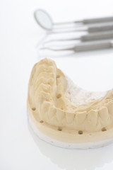 Fototapeta na wymiar Orthodontic Dental Cast