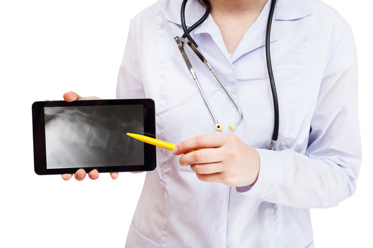 nurse points on tablet pc with vertebral column