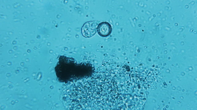 Decomposing Flesh With Bacteria Microscope