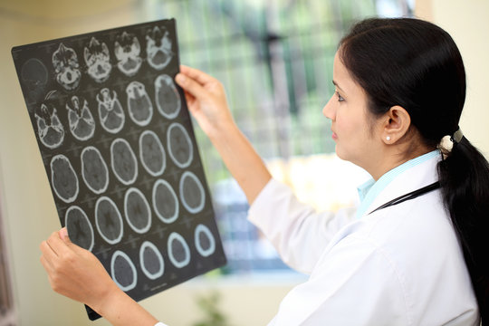 Female doctor examining a brain computerized tomography scan