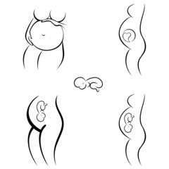 Schwangerschaft - silhouette set