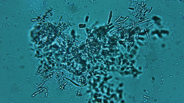 Bacteria Colony Sample 800x Microscope View