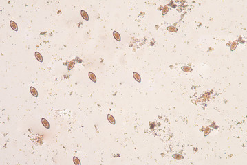 The human whipworm (Trichuris trichiura or Trichocephalus trichi