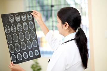 Female doctor examining a brain computerized tomography scan