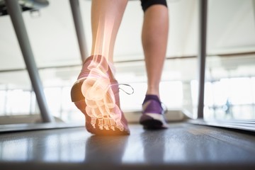 Fototapeta Highlighted foot bones of jogging woman obraz