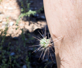 The Jumping Cholla cactus prickly plant with barbed spines  to d