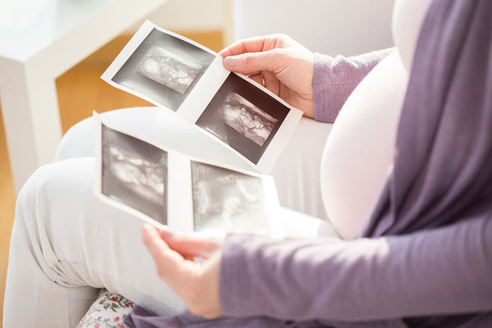 Future mother watching ultrasound photos