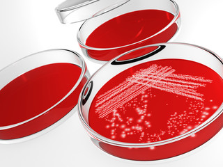 Petri dish with bacteria isolated on white background