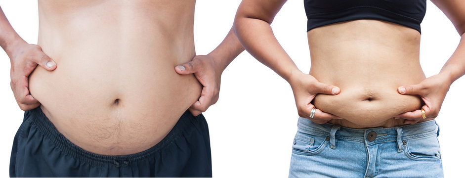 men and women body with fat belly and stretch marks