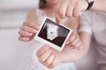 Ultrasound picture of a child in the hands of parents - 82229881