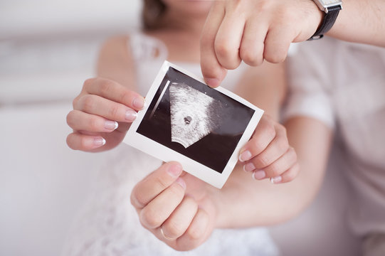 Ultrasound picture of a child in the hands of parents