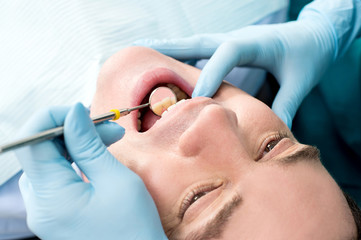 Obraz na płótnie Canvas Teeth examined by dentist