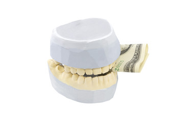 Dental phantom dentures isolated on white background with money