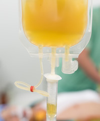 giving fresh frozen plasma blood components during surgery