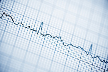 Electrocardiogram