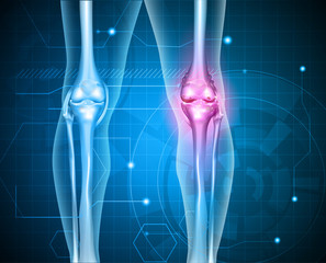 Knee pain abstract background