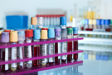 tubes with blood samples in a rack