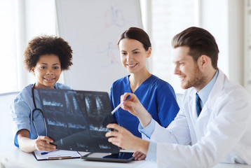 Fototapeta premium group of happy doctors discussing x-ray image