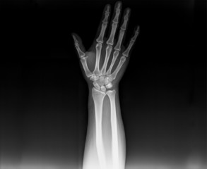 x-ray image