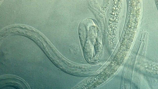 Roundworm, a free-living, transparent nematode