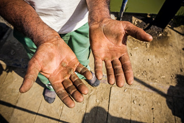 Injured open palms