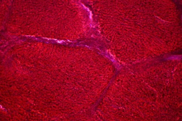 Lebergewebe Lichtmikroskop Vergr&ouml;&szlig;erung  400x