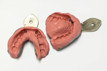 dental laboratory, casts