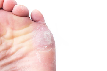 Fototapeta premium corn on foot