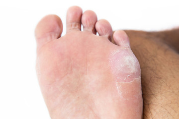 Fototapeta premium corn on foot