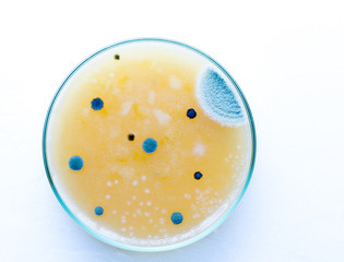 Petri dish with pathological microbe colonies