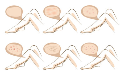Legs concept of anti aging procedures on skin