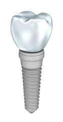 Dental implant isolated on white