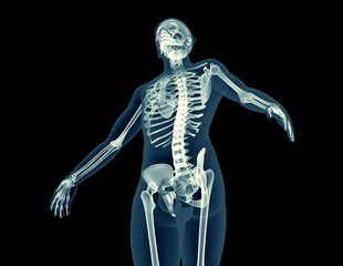 Fototapeta na wymiar x-ray image of a human body