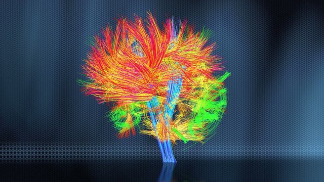 The connectome of the human brain.
