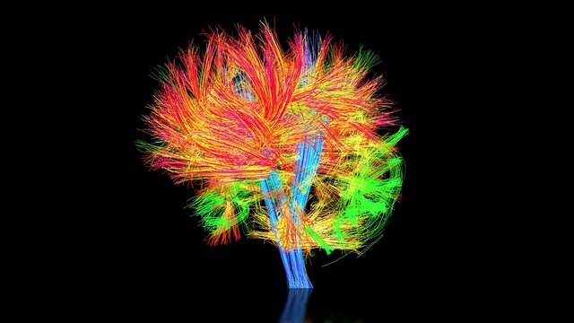 The connectome of the human brain.
