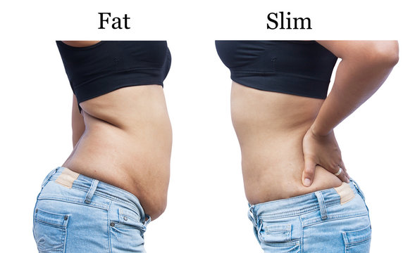 women body  fat and Slim after weight loss
