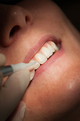 Zahn laser behandlung