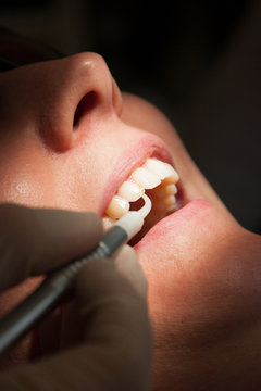 dental laser behandlung zahnfleisch