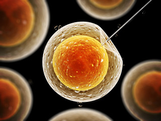 Artificial insemination