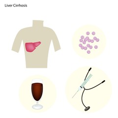 Liver Cirrhosis Concept with Disease Treatment